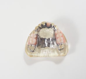 金属床義歯
