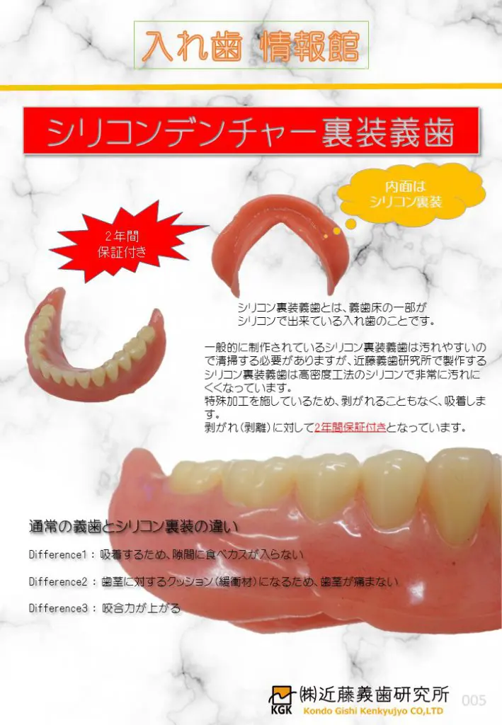 シリコンデンチャー裏装義歯 - 入れ歯情報館｜ 歯科技工所なら入れ歯 